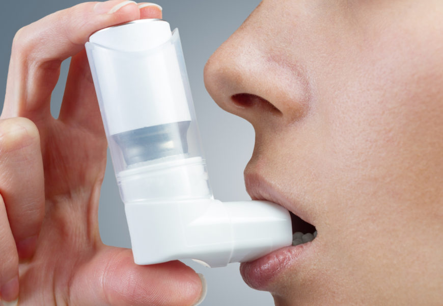 List of Common Allergic Diseases