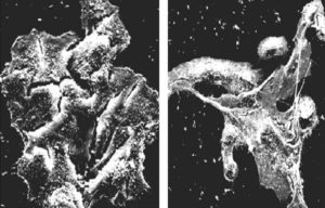How to Slow Down the Growth of Cancer Cells With Erlotinib